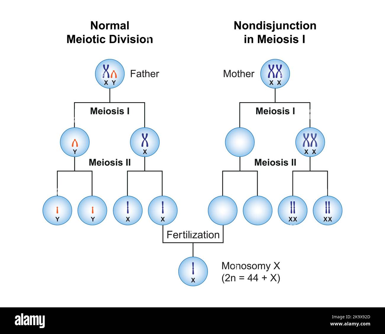 Conception scientifique de la non-disjonction en monosomie X (syndrome de Turner) . Symboles colorés. Illustration vectorielle. Illustration de Vecteur