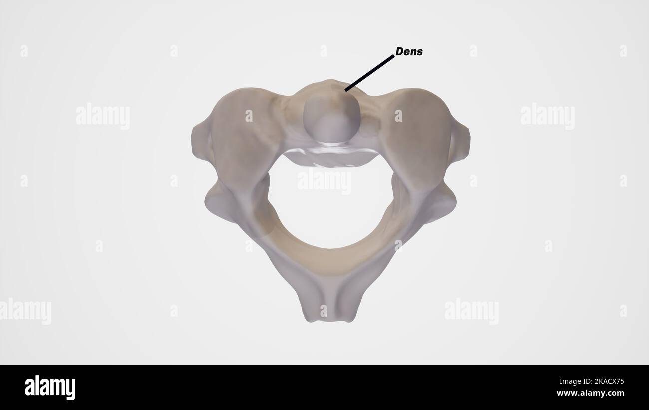 Rachis cervical, deuxième vertèbre cervicale (axe) - vue supérieure étiquetée Banque D'Images