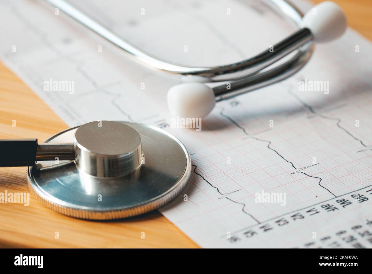 Diagramme EKG de fréquence cardiaque et stéthoscope médical, concept, bilan de santé et examen, infarctus du myocarde suspecté. Banque D'Images