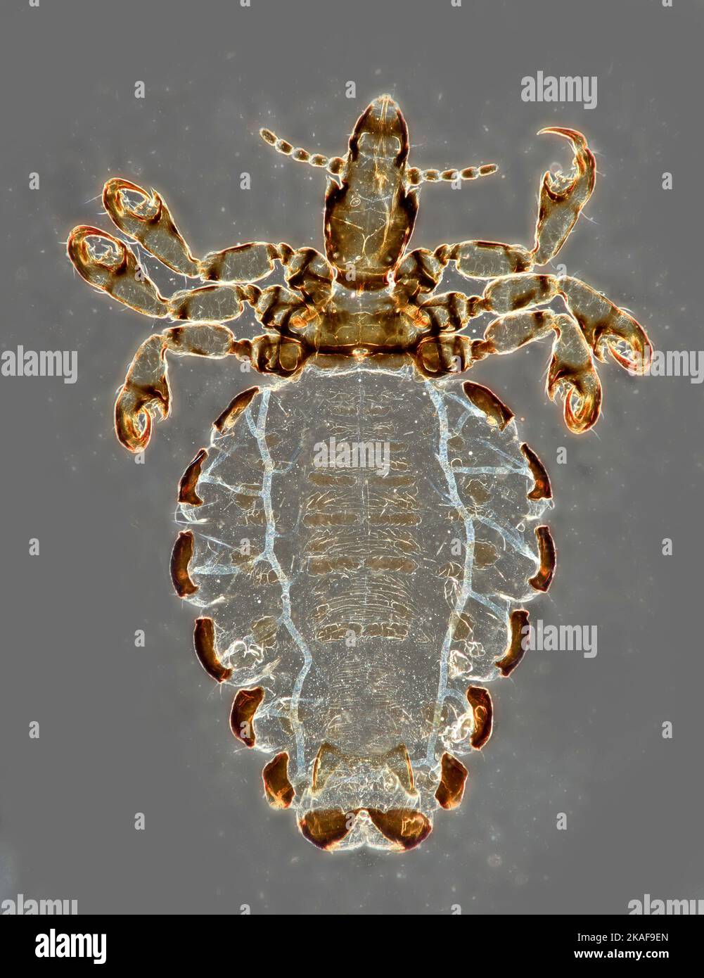 Haematopinus suis, la souris de porc, photomicrographe Banque D'Images