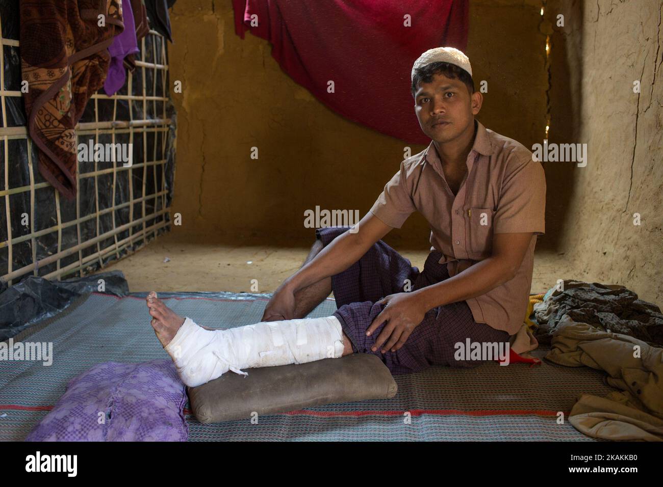 Noor Alam est un nouveau réfugié Rohingya dans le camp de réfugiés de Kutupalong, Cox's Bazar, au Bangladesh. L'armée birmane a tiré sur sa jambe en fuyant le Myanmar. 7 février 2017. Après les attaques des militants Rohingya sur des postes de police frontaliers à 9 octobre 2016, l'armée birmane a entrepris une série d'« opérations de dédouanement » dans le nord de l'État de Rakhine. Les forces de sécurité ont exécuté sommairement des hommes, des femmes et des enfants, pillé des biens et incendié au moins 1 500 maisons et autres bâtiments. Plus de 69 000 Rohingya se sont enfuis au Bangladesh. Actuellement, le nombre est d'environ 70 000. (Photo de Turjoy Chowdhury/NurPhoto) *** PLE Banque D'Images