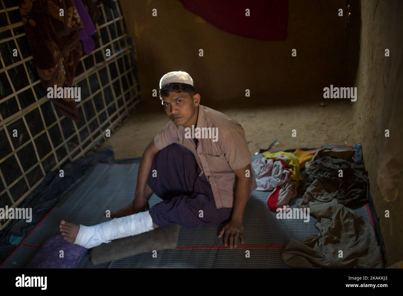Noor Alam est un nouveau réfugié Rohingya dans le camp de réfugiés de Kutupalong, Cox's Bazar, au Bangladesh. L'armée birmane a tiré sur sa jambe en fuyant le Myanmar. 7 février 2017. Après les attaques des militants Rohingya sur des postes de police frontaliers à 9 octobre 2016, l'armée birmane a entrepris une série d'« opérations de dédouanement » dans le nord de l'État de Rakhine. Les forces de sécurité ont exécuté sommairement des hommes, des femmes et des enfants, pillé des biens et incendié au moins 1 500 maisons et autres bâtiments. Plus de 69 000 Rohingya se sont enfuis au Bangladesh. Actuellement, le nombre est d'environ 70 000. (Photo de Turjoy Chowdhury/NurPhoto) *** PLE Banque D'Images