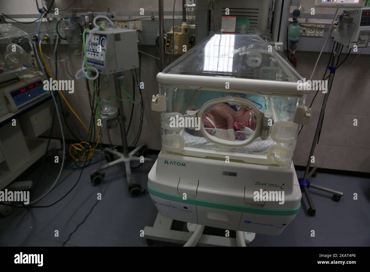 Une paire de sœurs jumelles jointes, nées samedi, se trouvent dans un incubateur à l'hôpital de Shifa, dans la ville de Gaza, le 26 octobre 2017. Le Dr Allam Abu Hamda, un nouveau-né spécialiste de l'hôpital Shifa de Gaza, a déclaré lundi que les filles sont en état de santé 'table' et que les médecins ont commencé aux nourrir, mais ils auront besoin de soins à l'étranger. (Photo de Majdi Fathi/NurPhoto) Banque D'Images