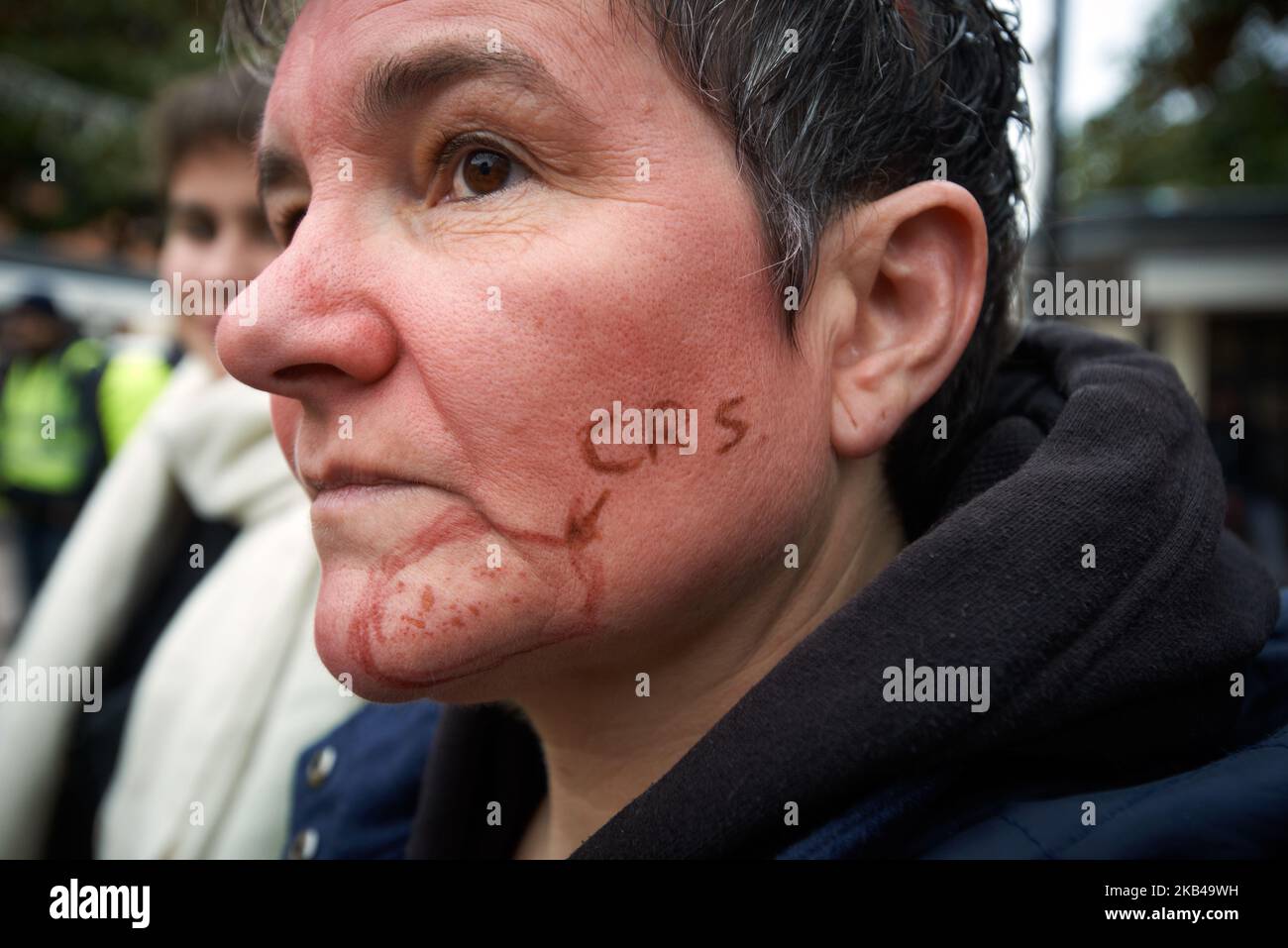 Une femme a encerclé une blessure légère causée par un coup par un homme de police anti-émeute. Les gilets jaunes se sont rassemblés à Toulouse pour protester contre la violence policière plus de 5000 personnes ont été arrêtées depuis 17 novembre, en France, plus de 250 personnes ont été blessées à Toulouse depuis 1 décembre 2018. Dans toute la France, plus d'une douzaine de personnes ont perdu l'œil en raison de l'usage incrimé du ballon rond ou de la perte d'un membre (main ou pied). Le mouvement des jaquettes jaunes a commencé pacifiquement sur 17 novembre par une protestation contre la hausse des taxes sur les produits pétroliers. À Toulouse, France sur 23 décembre 2018. (Photo Banque D'Images