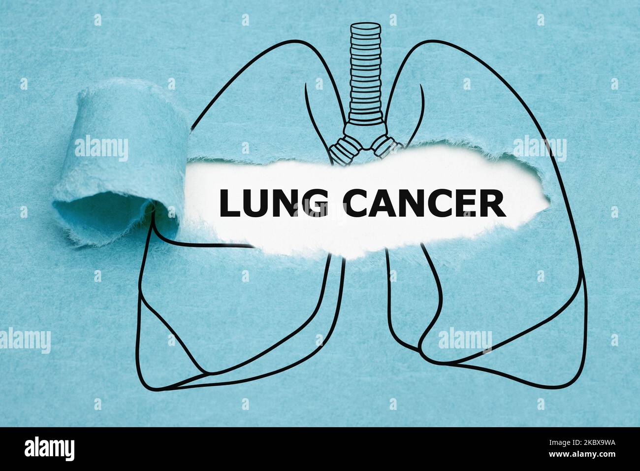 Texte cancer pulmonaire apparaissant derrière un papier bleu déchiré dans le concept de poumons humains dessinés. Banque D'Images