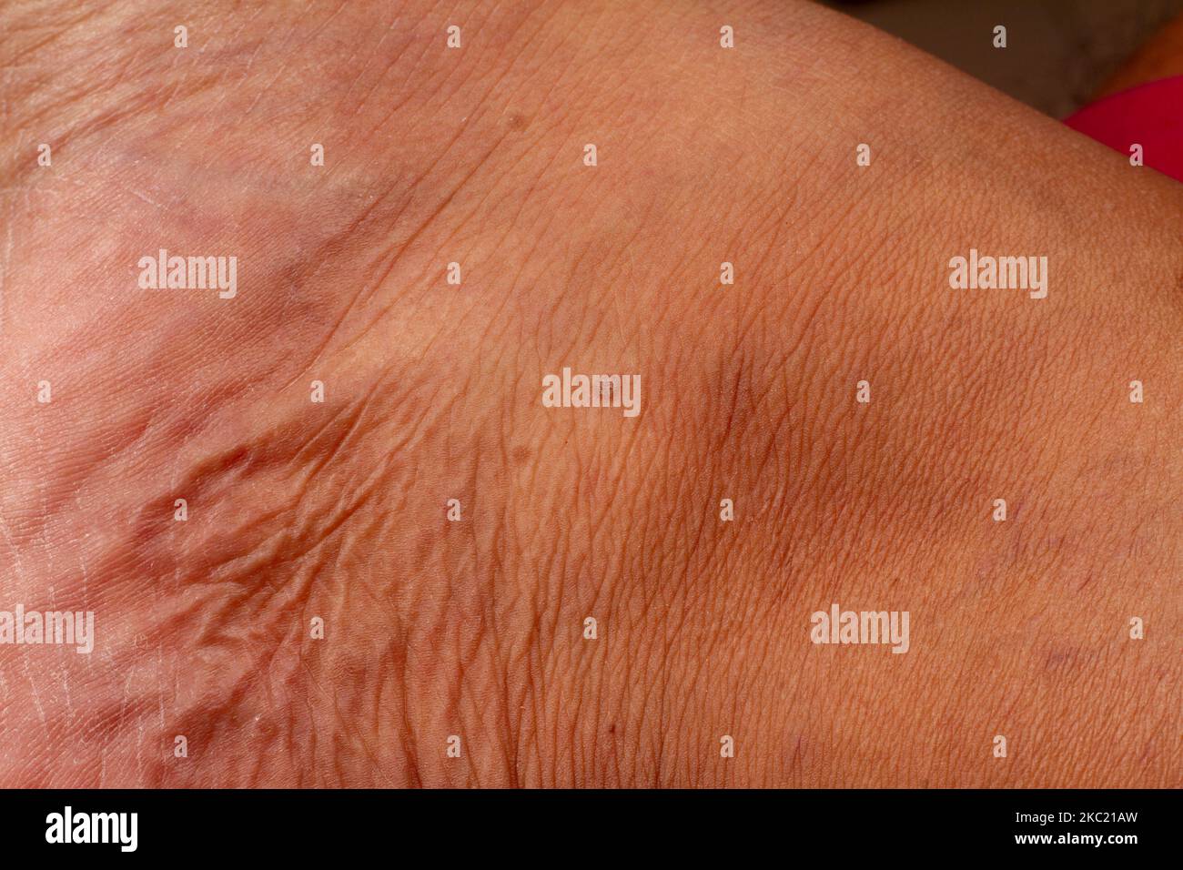 texture de la peau humaine. Micro-photo de la peau avec déformation plate. Gros plan. Banque D'Images
