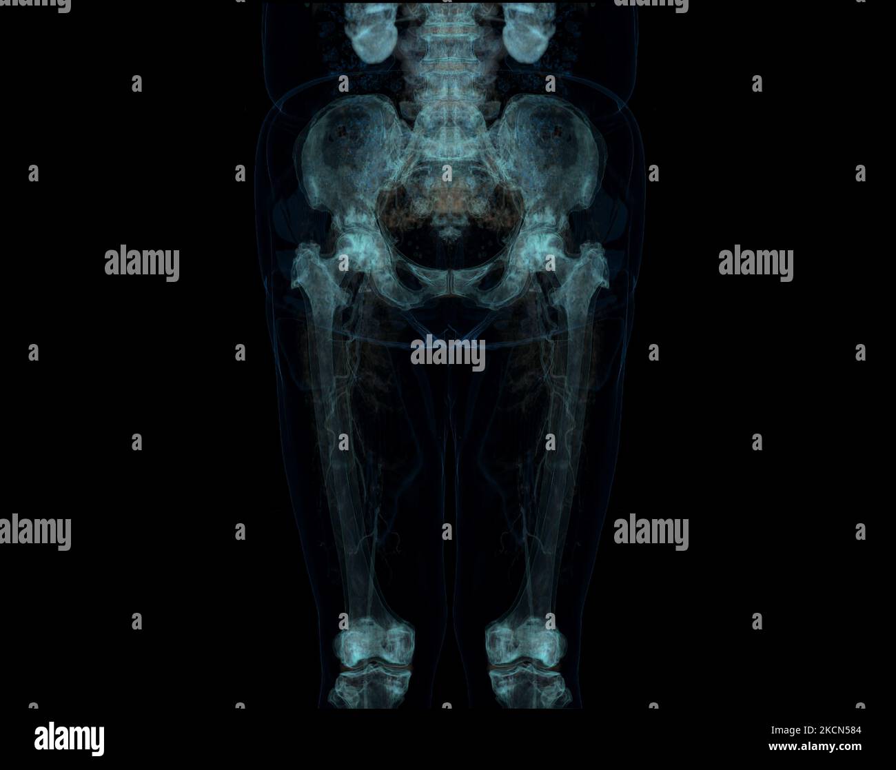 Scanner de l'extrémité inférieure ,3D illustration de l'os du fémur , de l'articulation du genou , de la jambe et du pied . Banque D'Images Scanner de l'extrémité inférieure ,3D illustration de l'os du fémur , de l'articulation du genou , de la jambe et du pied . Banque D'Images