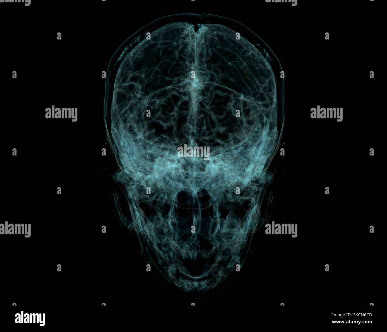 Crâne humain, cerveau par acquisition CT. Visualisation des rayons X à l'intérieur du crâne. 3D rendu d'illustration. Banque D'Images