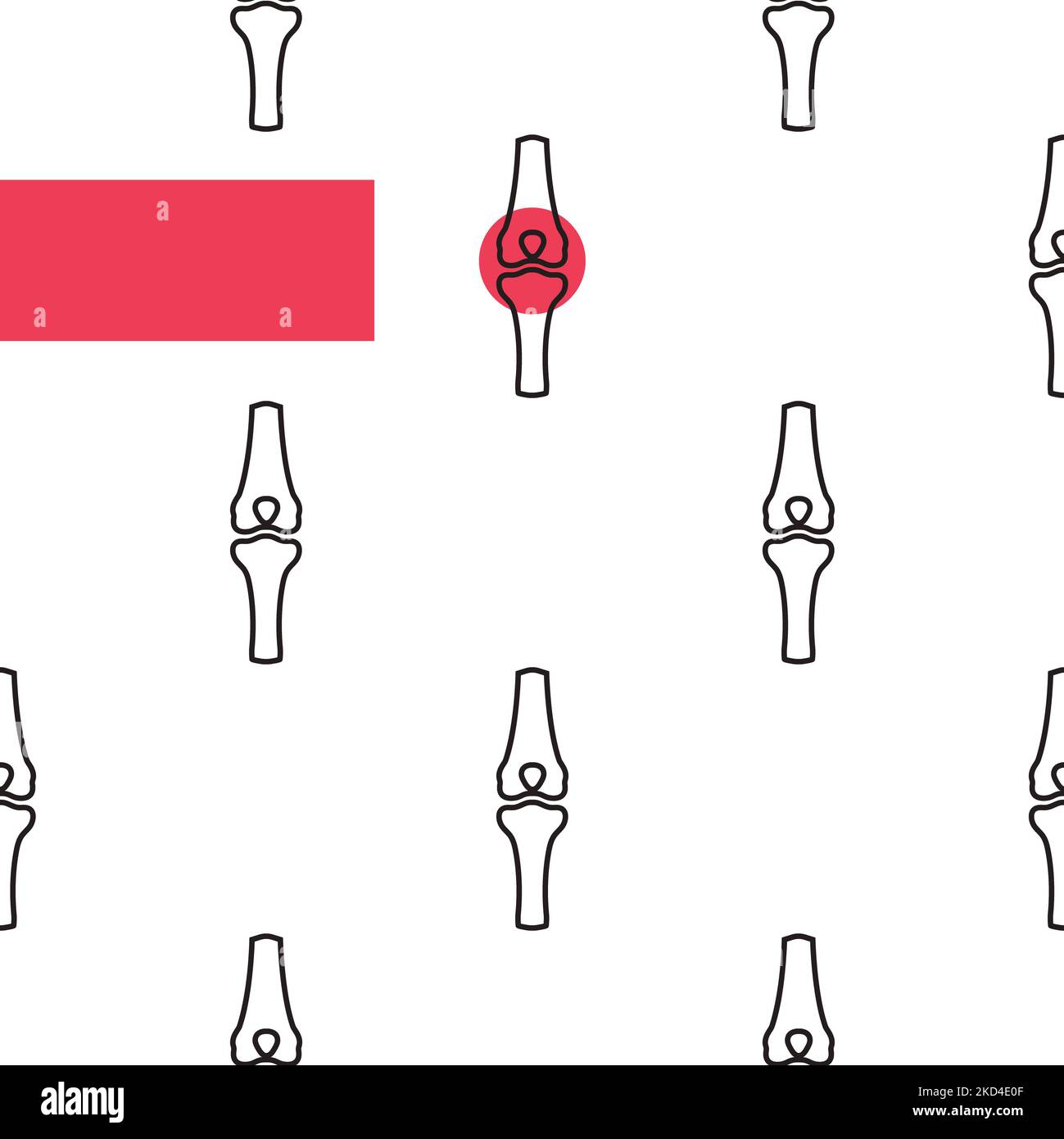 Arthrose, illustration conceptuelle Banque D'Images