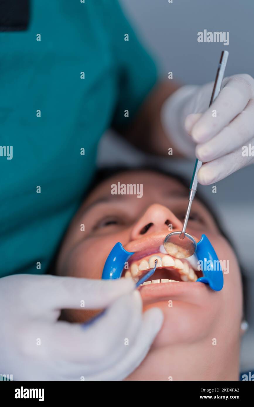 Grand angle de jeune femme ethnique avec enrouleur de joue allongé sur la chaise tandis que croiser un dentiste anonyme en utilisant le miroir de bouche pour appliquer le remplissage pendant Banque D'Images Grand angle de jeune femme ethnique avec enrouleur de joue allongé sur la chaise tandis que croiser un dentiste anonyme en utilisant le miroir de bouche pour appliquer le remplissage pendant Banque D'Images