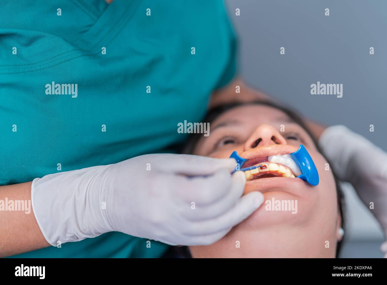 Culture stomatologiste non reconnaissable fixant le remplissage dentaire sur les dents de jeune hispanique femme patiente allongé sur une chaise avec l'enrouleur de joue dans la bouche ouverte Banque D'Images Culture stomatologiste non reconnaissable fixant le remplissage dentaire sur les dents de jeune hispanique femme patiente allongé sur une chaise avec l'enrouleur de joue dans la bouche ouverte Banque D'Images