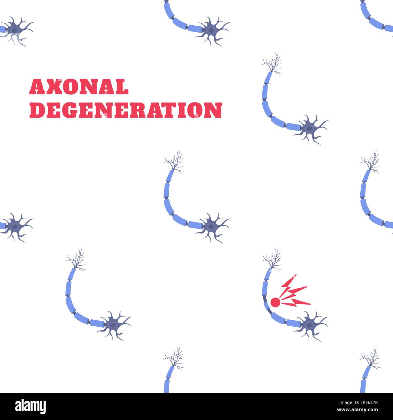 Dégénérescence des nerfs axonaux maladie conscience neurone modèle Illustration de Vecteur