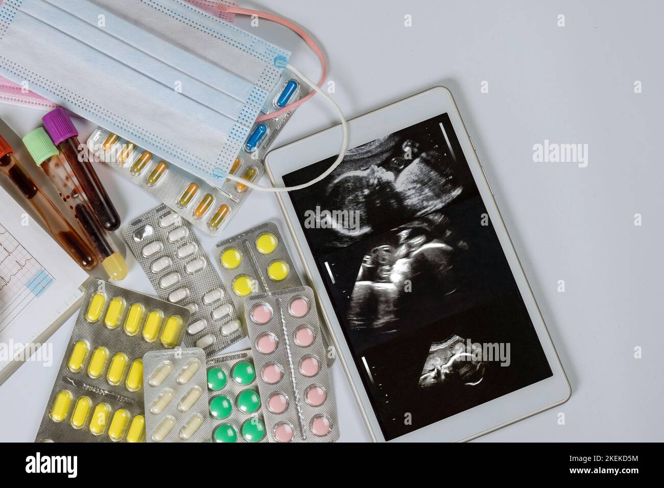 Au cours de l'échographie prénatale et du cardiogramme, le médecin prescrira un traitement pour préserver le bébé dans l'utérus différents médicaments seront prescrits Banque D'Images