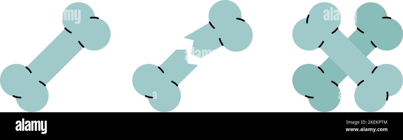 Ensemble de symboles d'os différents. Icônes d'os colorées. Orthopédie, réadaptation médicale, symbole de fracture. Illustration vectorielle. Icônes des os humains Illustration de Vecteur