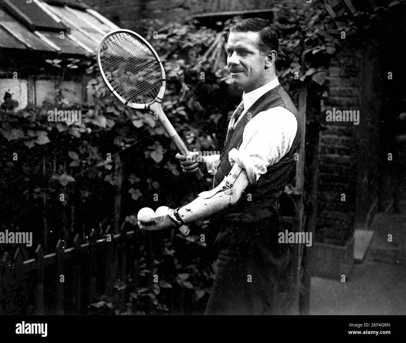 M. F M Parncutt, qui n'a qu'un seul bras, mais est toujours en mesure de  jouer au tennis grâce à une main spécialement adaptée sur son bras  artificiel, qui est conçu pour