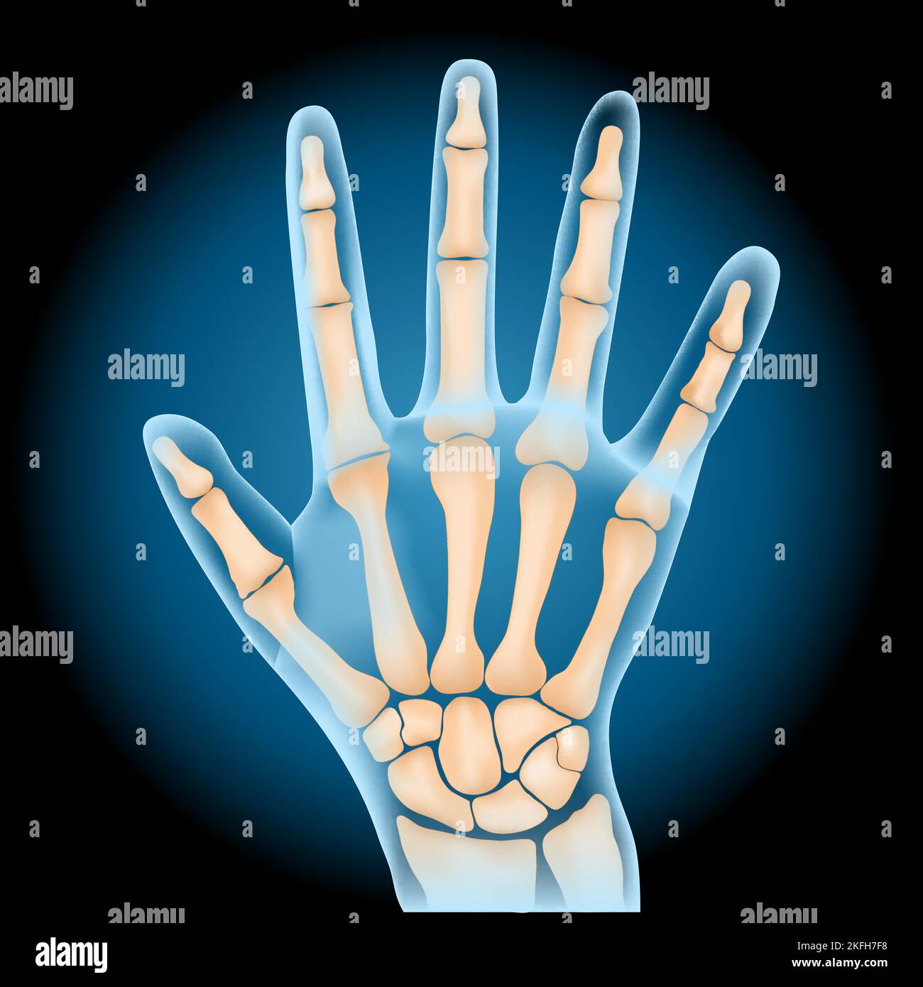 Os carpiens. Anatomie de la main humaine. Petits os du poignet : scaphoïde, lunaire, Triquetrum, Pisiforme, Trapezium, Trapèze, capitule et hamate. Rayons X. Illustration de Vecteur