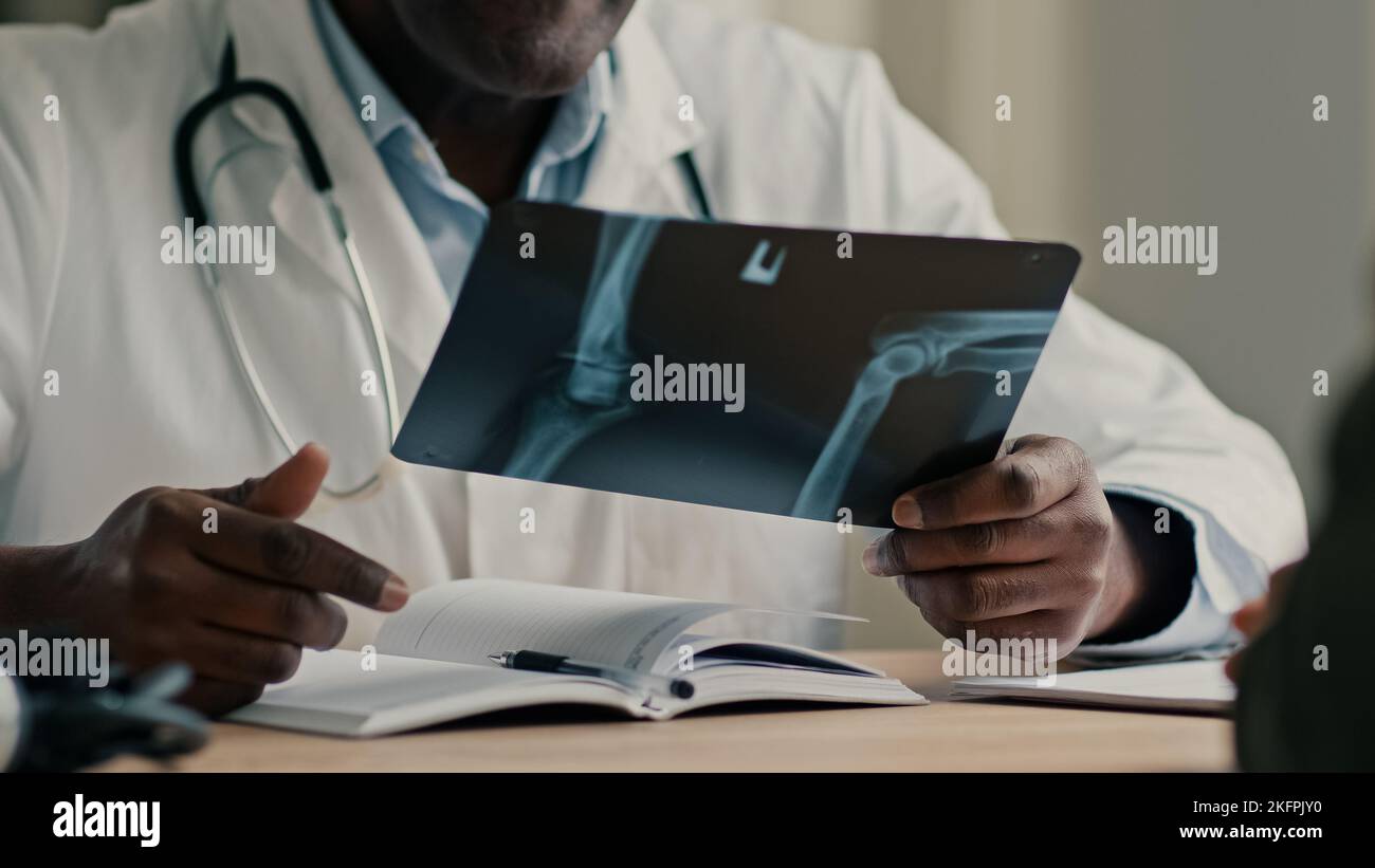 Homme méconnaissable médecin africain radiologue chirurgien thérapeute ostéopathe montrer le résultat de l'acquisition de rayons X IRM tomographie roentgen des os brisés joints à Banque D'Images