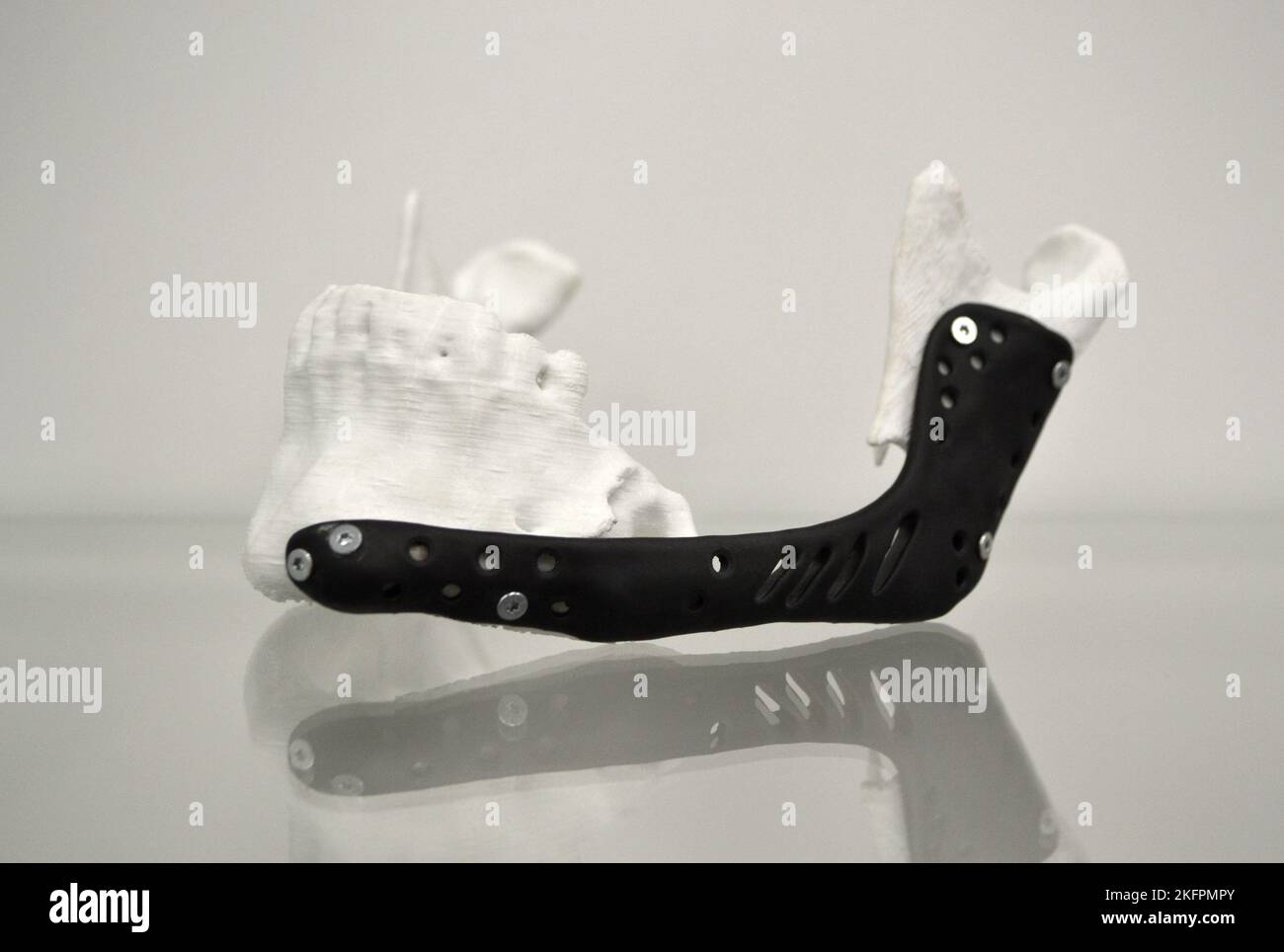 3D prototype de mâchoire inférieure humaine en plastique imprimé et gros plan sur l'implant médical en titane. Prothèse noire prototype anatomique d'os humain 3D imprimé à partir de poudre métallique. Prothèse orthopédique maxillo-faciale Banque D'Images