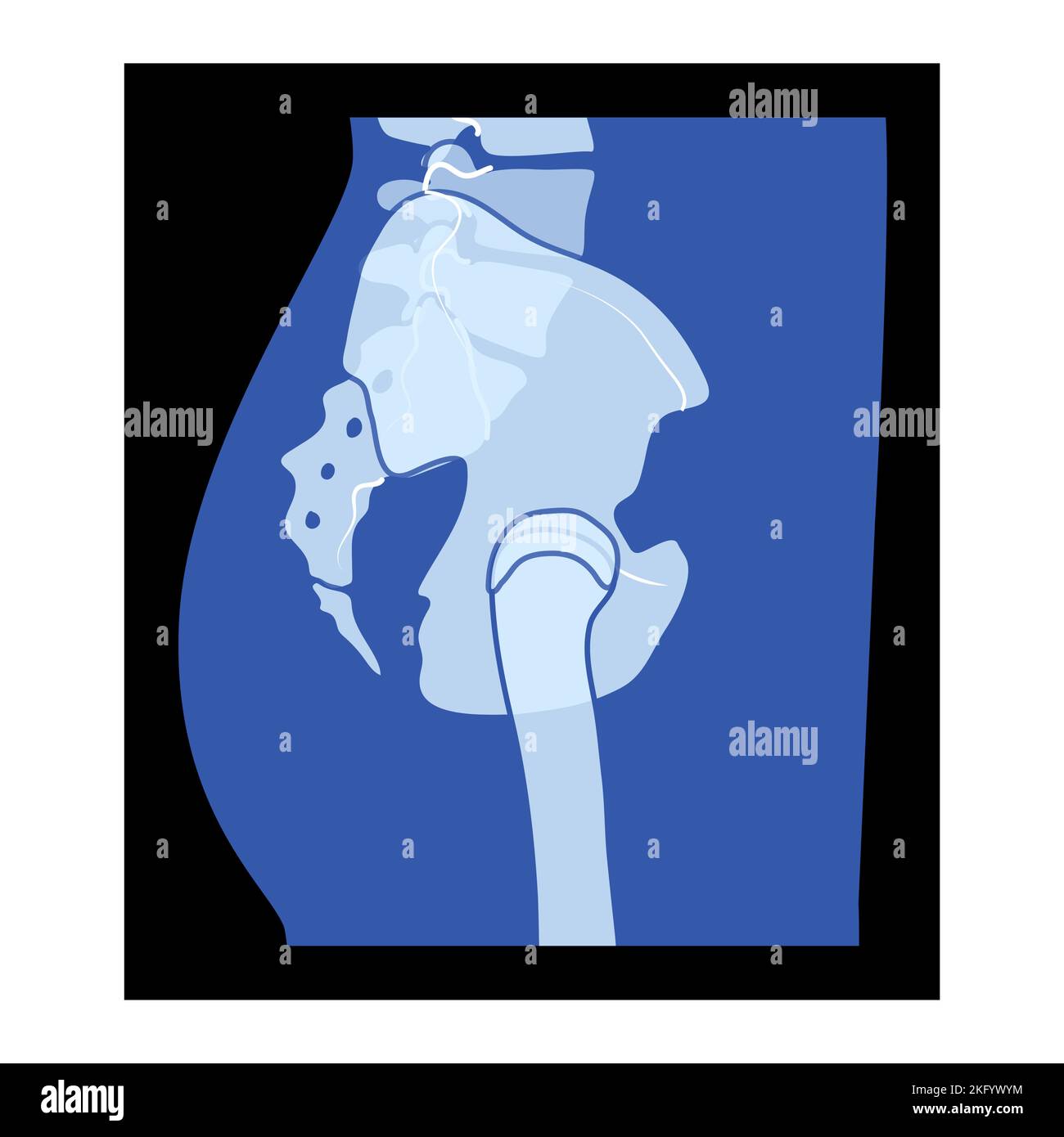 X-Ray pelvis Skeleton hanche corps humain os adultes personnes roentgen vue latérale. 3D concept bleu plat réaliste illustration vectorielle de l'anatomie médicale isolée sur fond noir Illustration de Vecteur