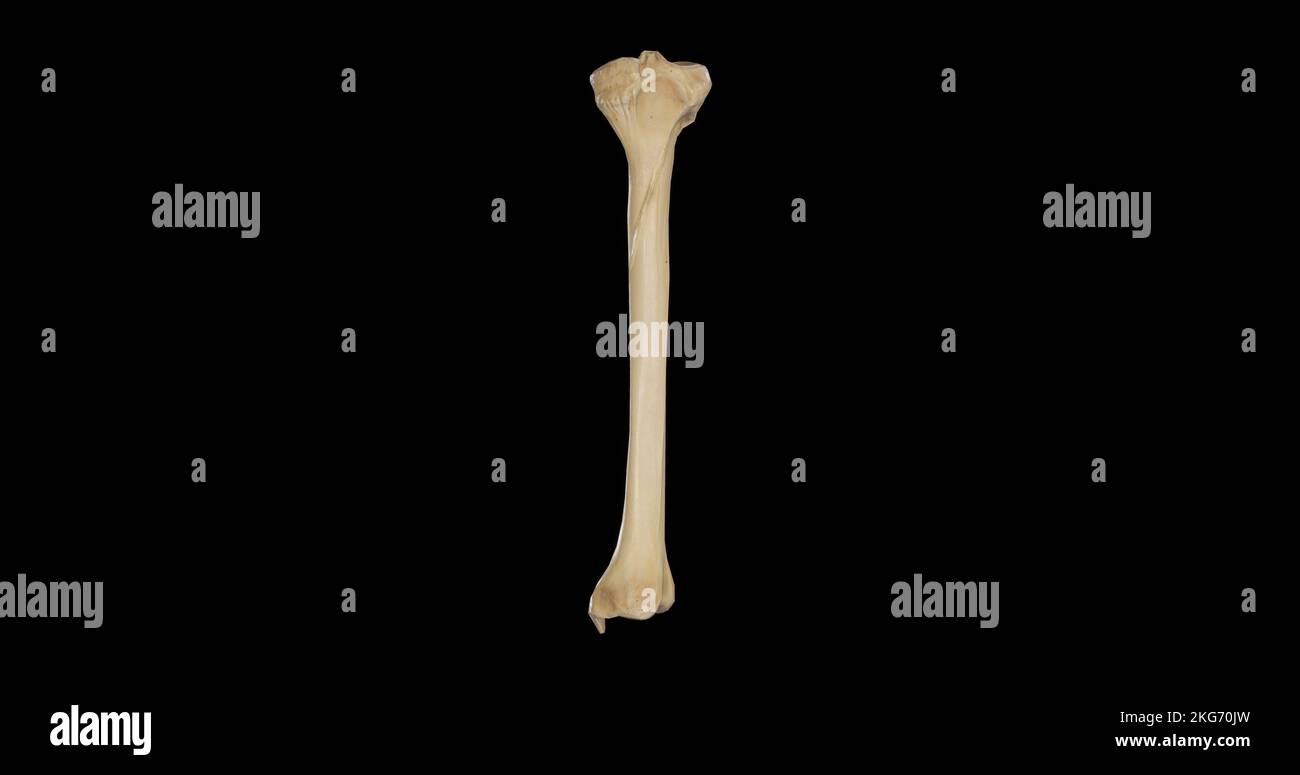 Os De La Jambe En 6 Lettres Péroné distal droit Banque de photographies et d'images à haute résolution  - Alamy