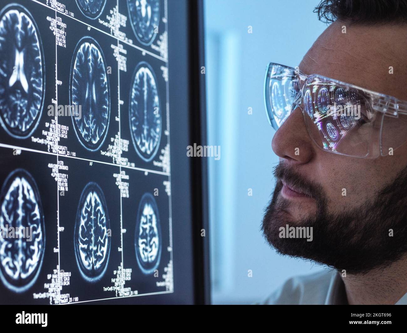 Médecin avec barbe examinant l'IRM du cerveau Banque D'Images