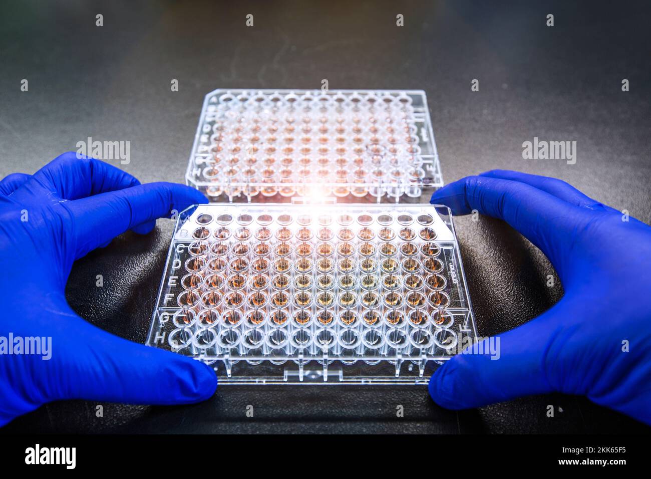 Le dosage de la concentration en protéines est l'une des méthodes utilisées dans l'analyse Western blot ou l'analyse de détection de protéines. Les chercheurs ou les scientifiques l'appliquent dans environ Banque D'Images
