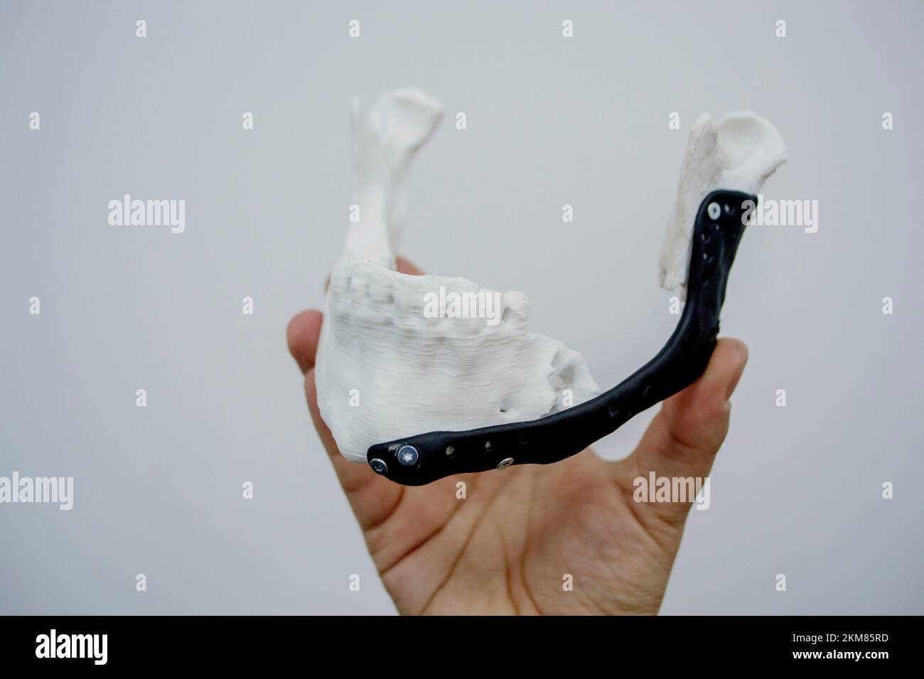 Personne tenant en main 3D prototype en plastique imprimé mâchoire inférieure humaine et implant médical en titane gros plan. Prothèse anatomique osseuse 3D imprimé à partir de poudre métallique. Prothèse orthopédique maxillo-faciale Banque D'Images