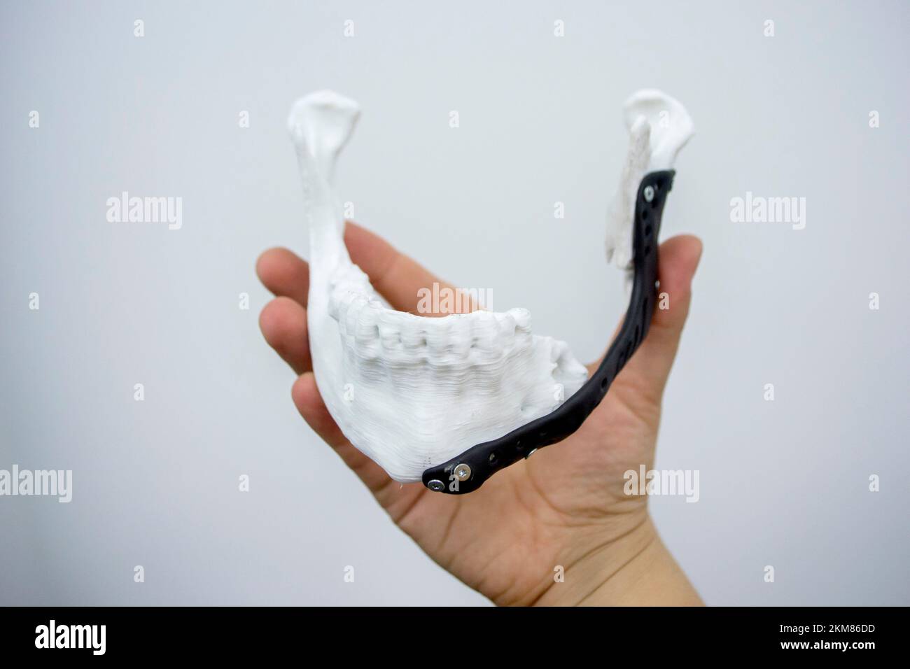 Personne tenant en main 3D prototype en plastique imprimé mâchoire inférieure humaine et implant médical en titane gros plan. Prothèse anatomique osseuse 3D imprimé à partir de poudre métallique. Prothèse orthopédique maxillo-faciale Banque D'Images