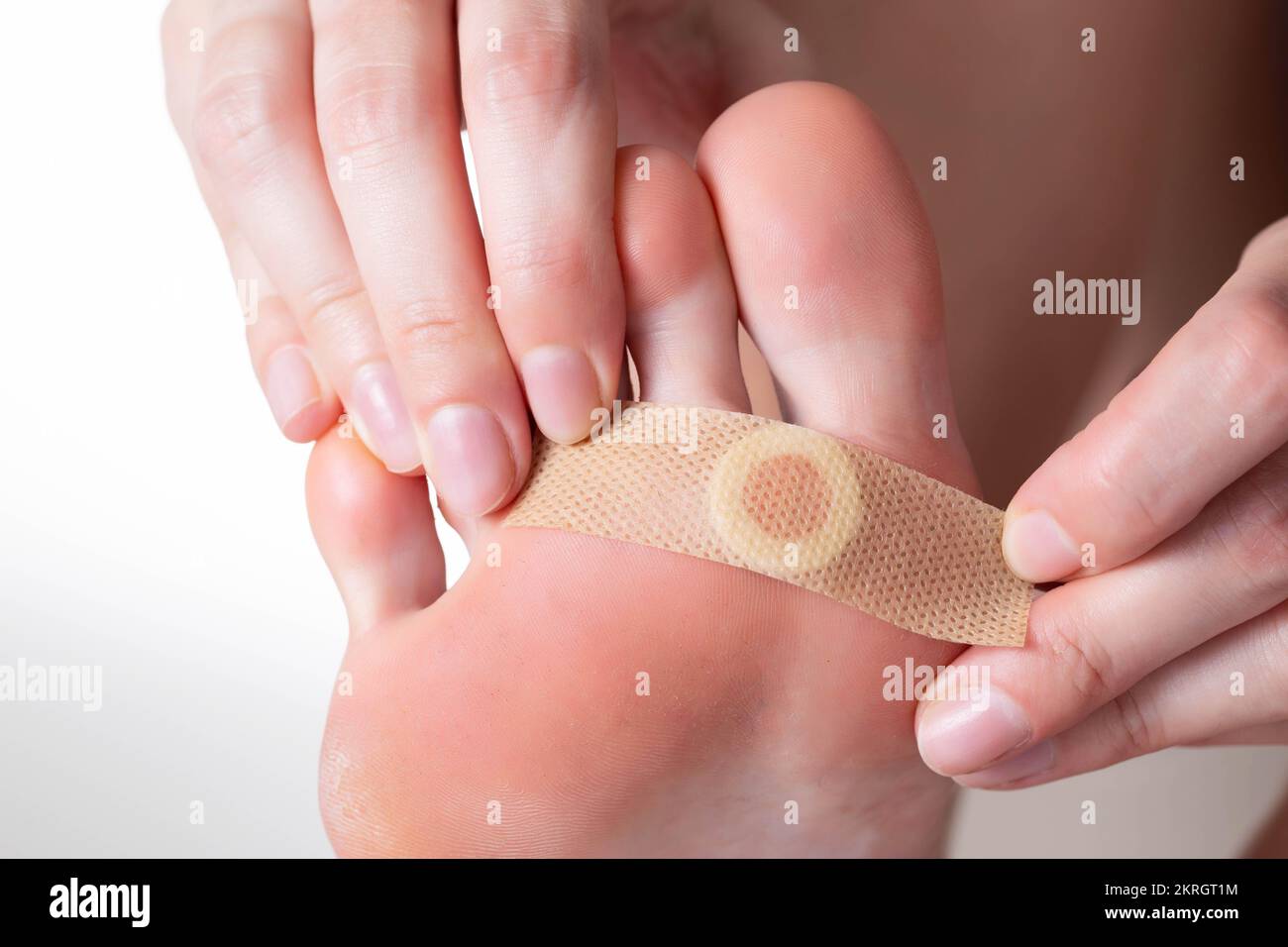 Une fille colle un plâtre médical pour verrues plantaires sur sa jambe. Traitement de callus Banque D'Images