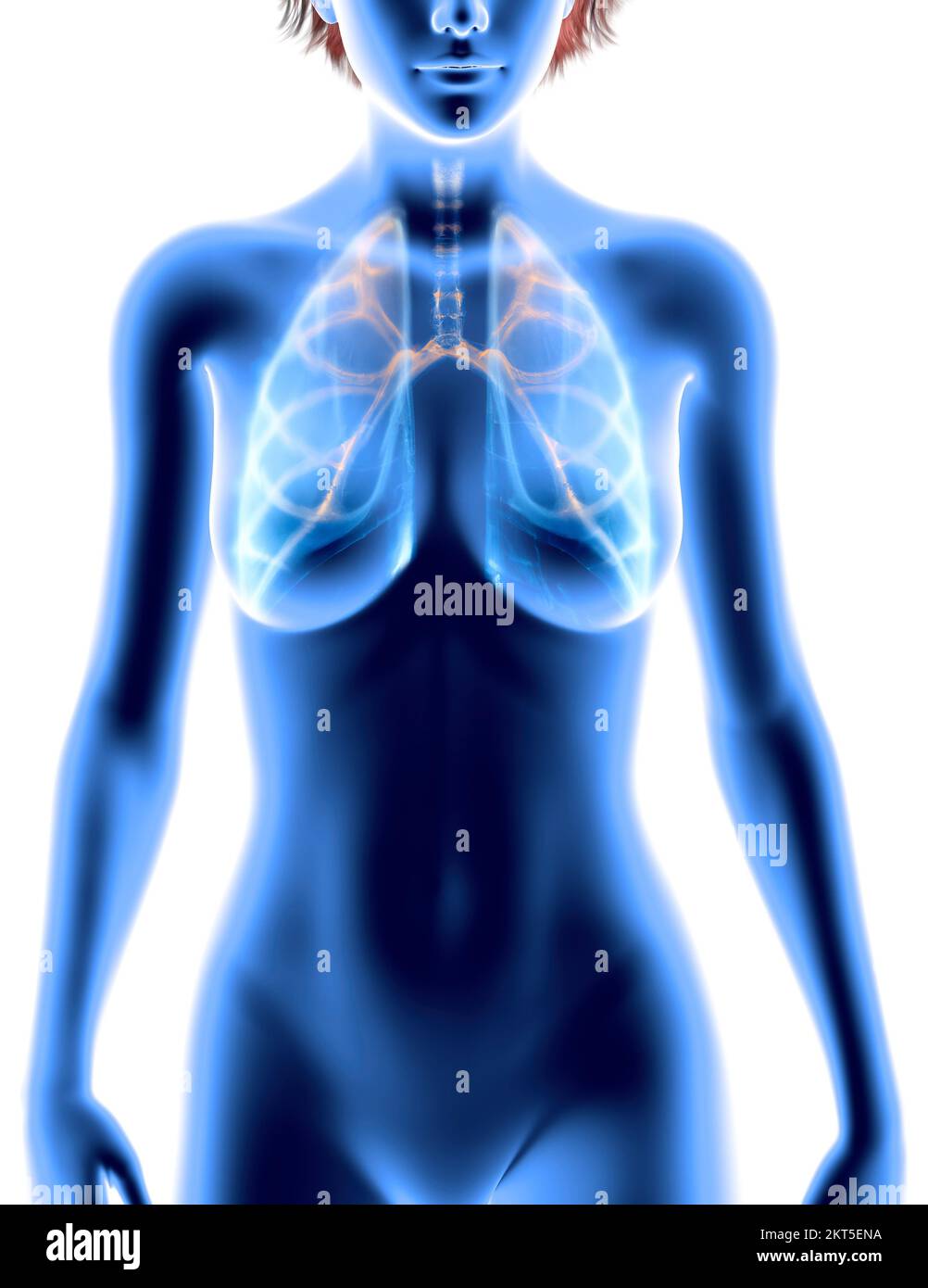Anatomie humaine, problèmes avec le système respiratoire, poumons gravement endommagés. Silhouette de femme Banque D'Images