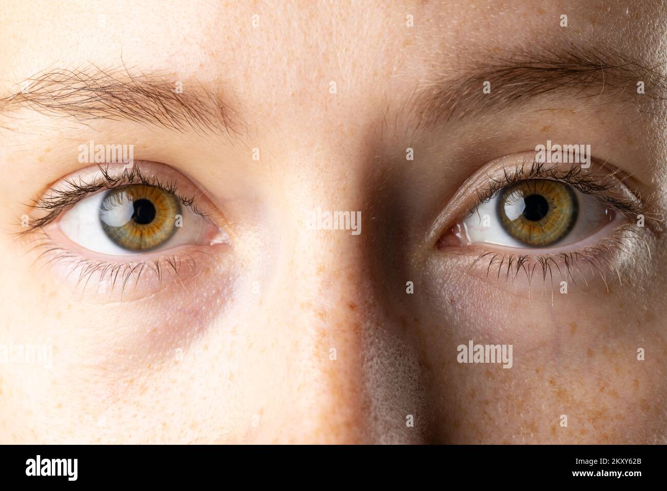 Gros plan des yeux bruns de la femme caucasienne avec des taches de rousseur Banque D'Images