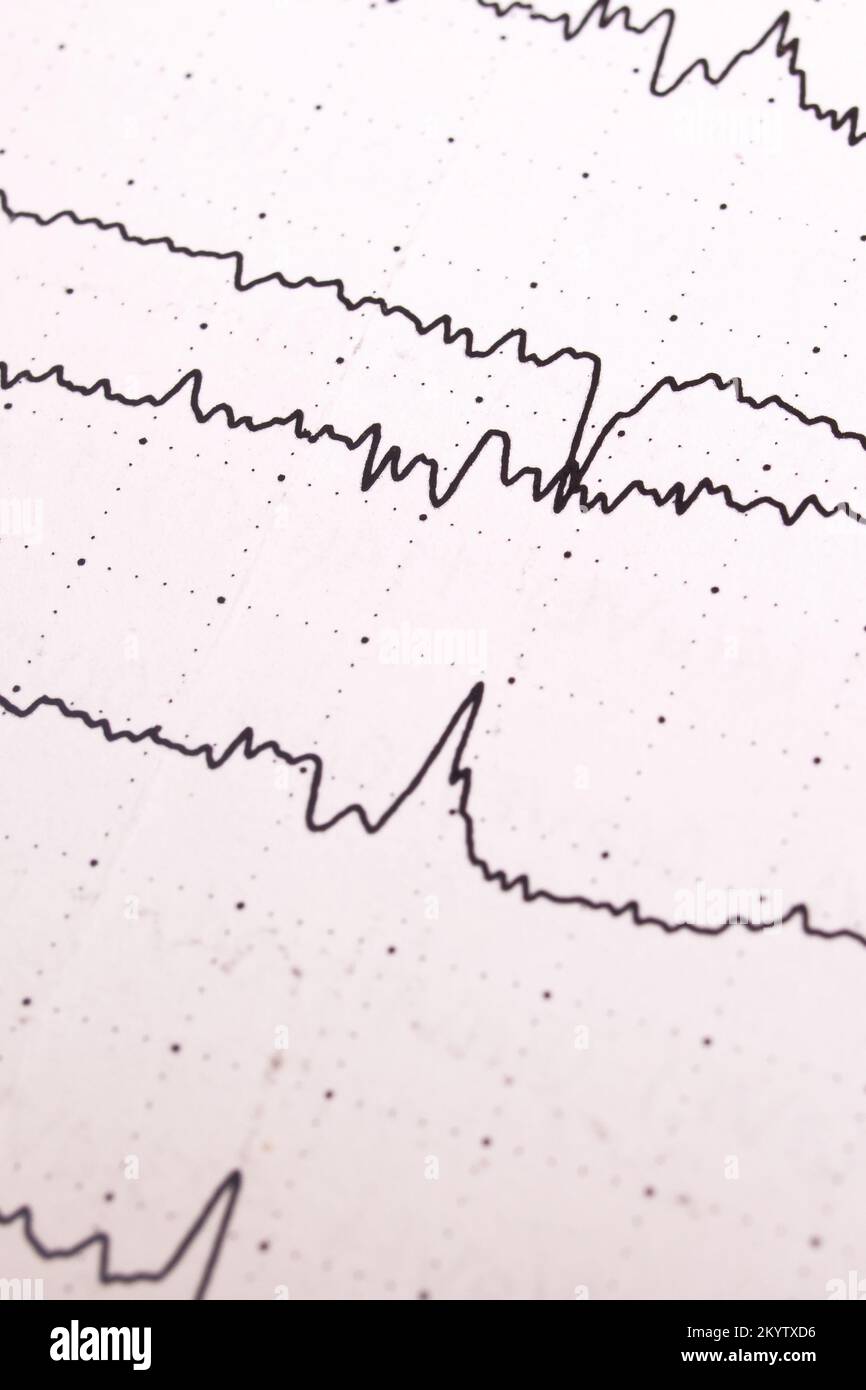 Électroencéphalogramme sur un livre blanc gros plan Banque D'Images