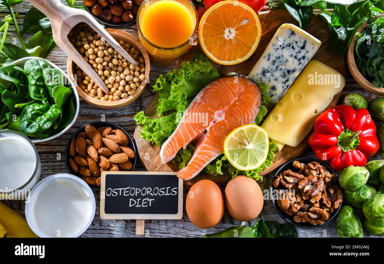 Produits alimentaires recommandés pour l'ostéoporose et les os sains. Banque D'Images