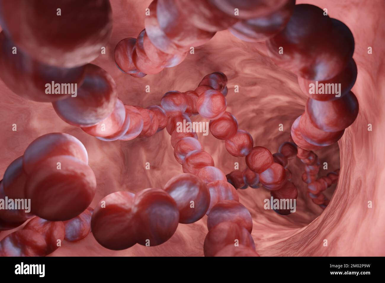 Streptocoque Structure bactérienne dans une gorge. Illustration de l'infection de la maladie invasive à streptocoque du groupe A (iGAS) Banque D'Images