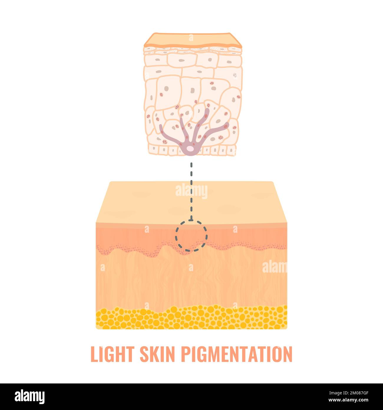 Schéma médical du mécanisme de pigmentation à coloration légère de la peau Illustration de Vecteur