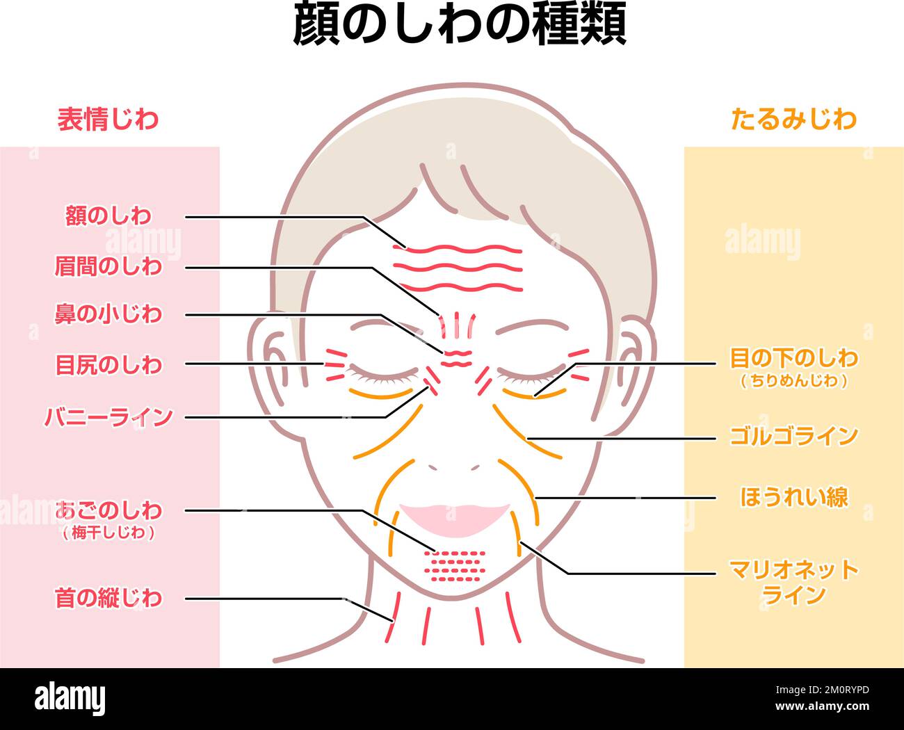 Rides d'expression et rides de vieillissement ( visage féminin ) Illustration vectorielle / Japonais Illustration de Vecteur