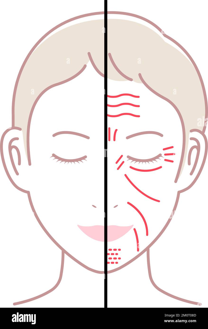 Rides faciales ( visage féminin ) illustration vectorielle / pas de texte Illustration de Vecteur