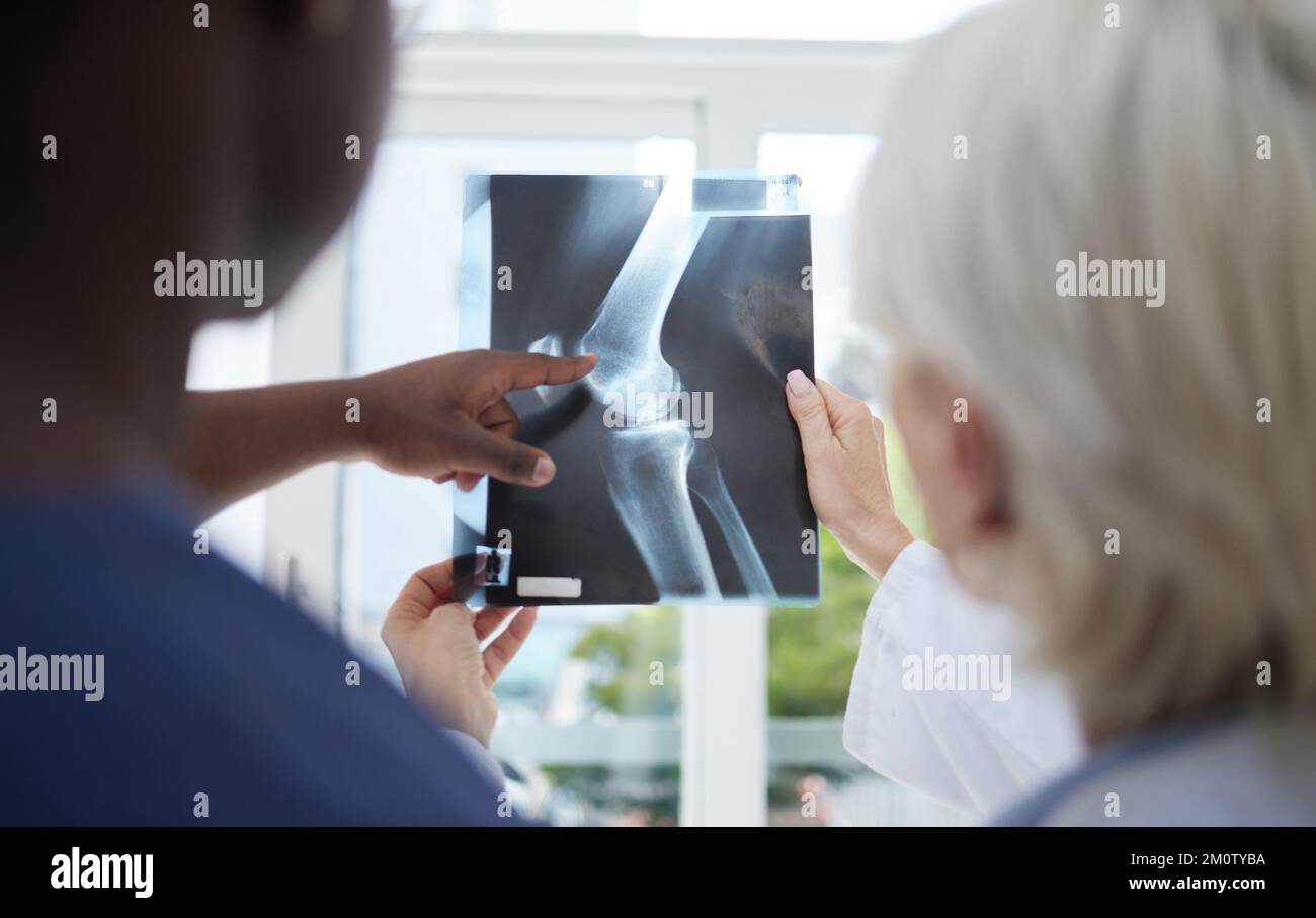 Tant de fractures dans un seul os. un médecin mature et sa collègue analysant une radiographie. Banque D'Images