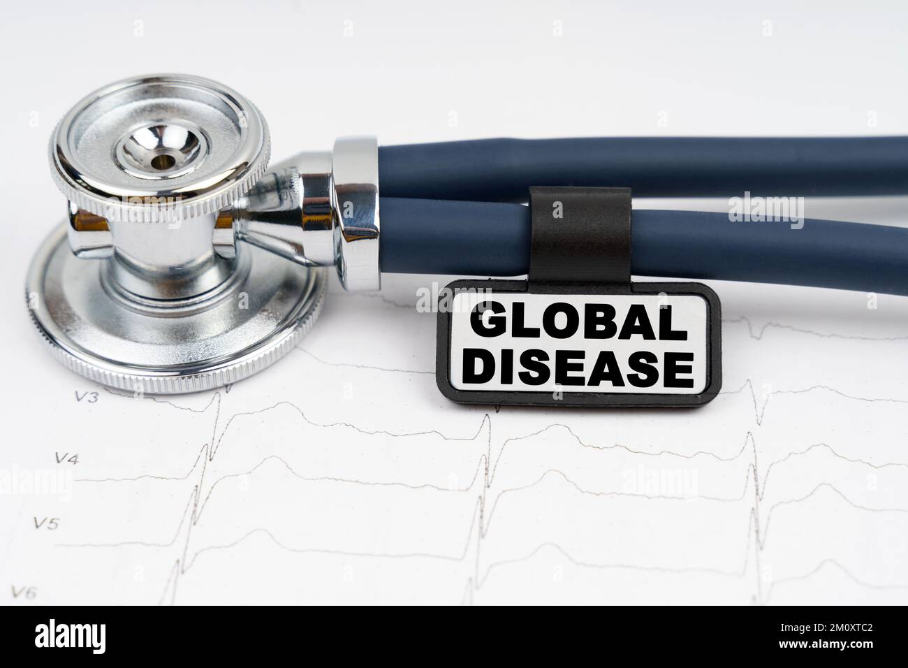 Médecine et concept de santé. Sur le cardiogramme se trouve un stéthoscope et une plaque avec l'inscription - MALADIE GLOBALE Banque D'Images