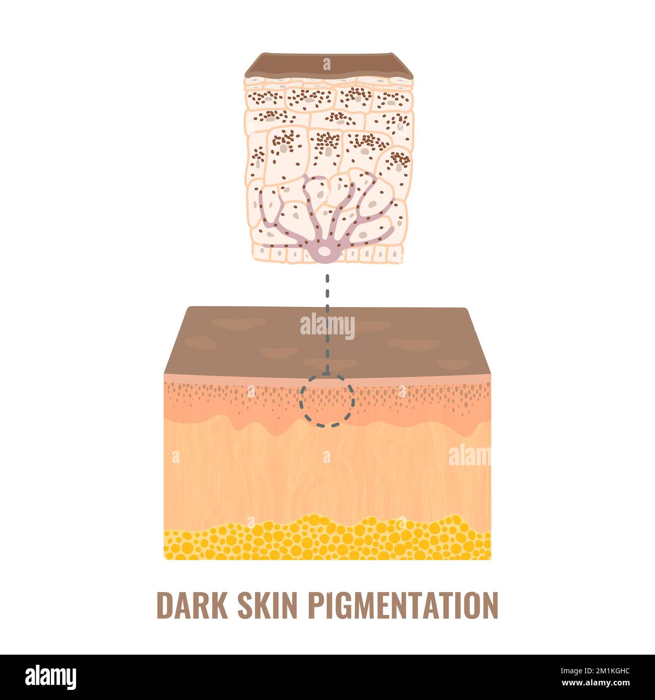 Mécanisme de pigmentation du teint de la peau dans la peau sombre Illustration de Vecteur