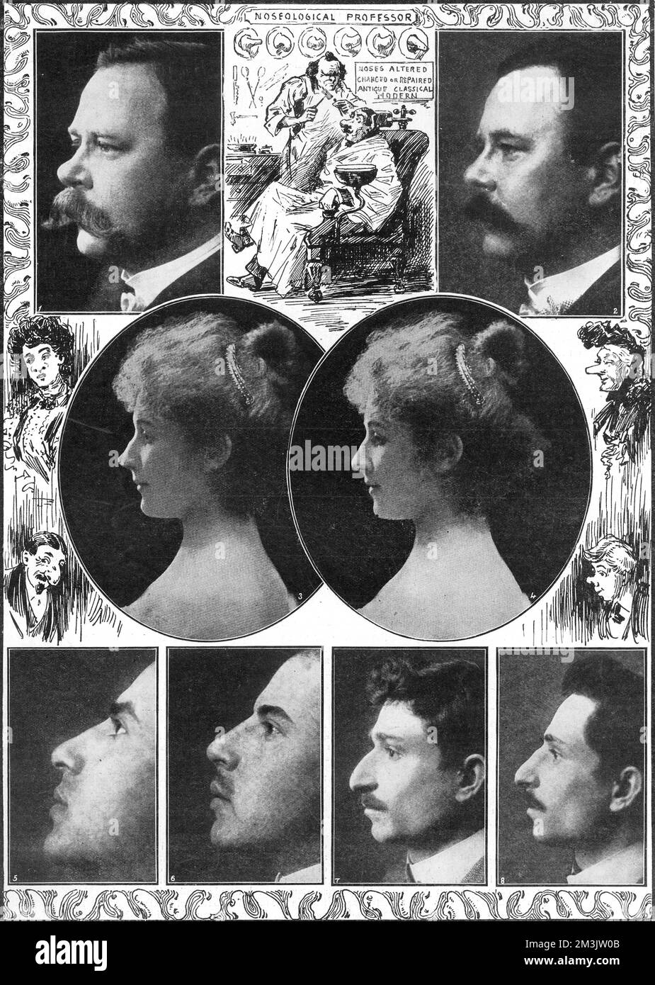 Exemples de chirurgie esthétique effectuée à Paris. La procédure a été effectuée sous anesthésie locale, généralement de la cocaïne. Date: 1907 Banque D'Images