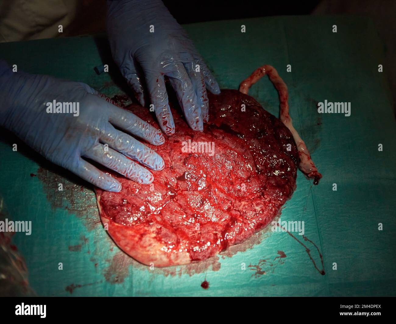 Un placenta sur une table peu après la naissance Banque D'Images