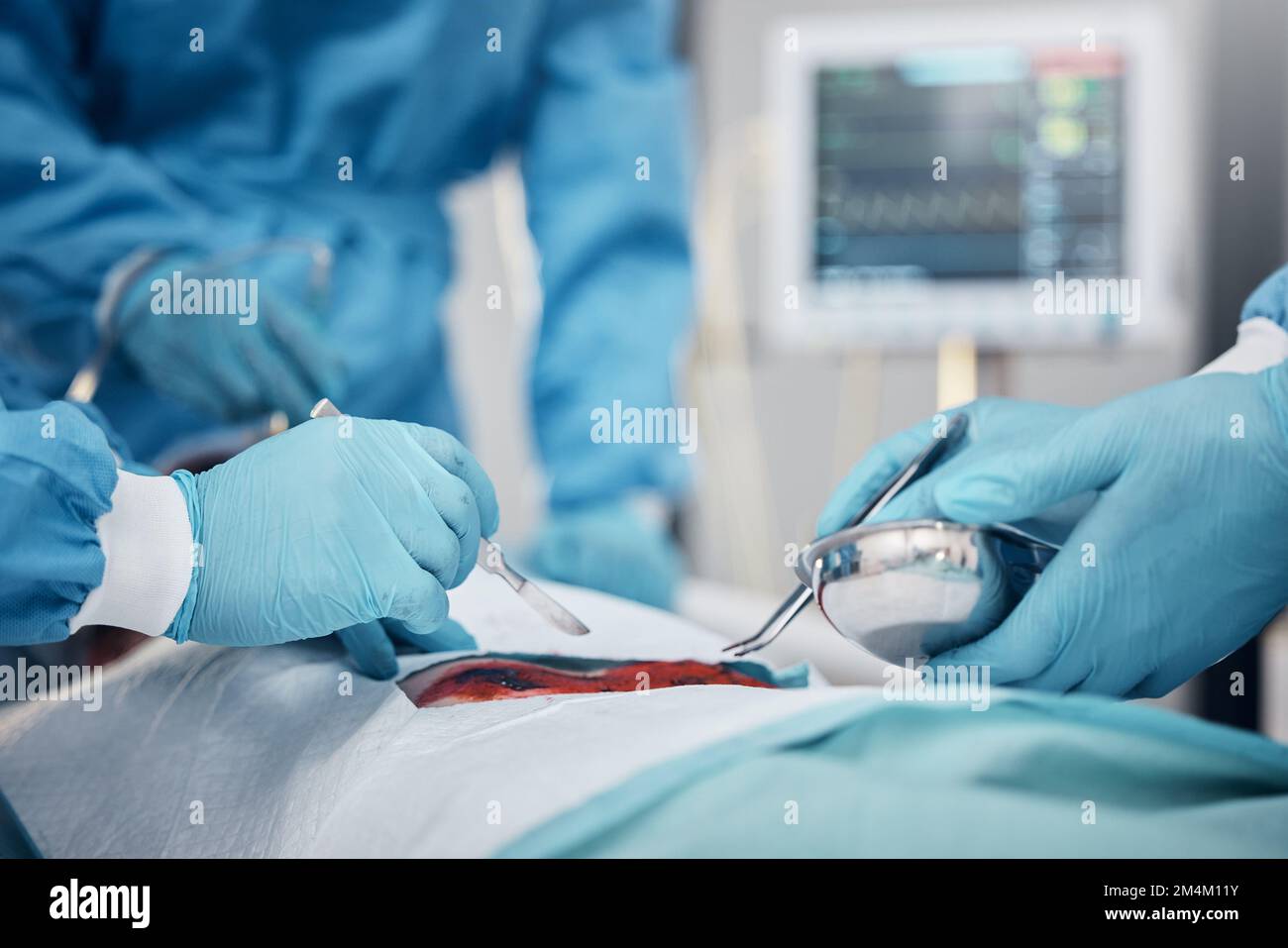 Mains, sang et opération avec une équipe de médecins au travail pendant ...