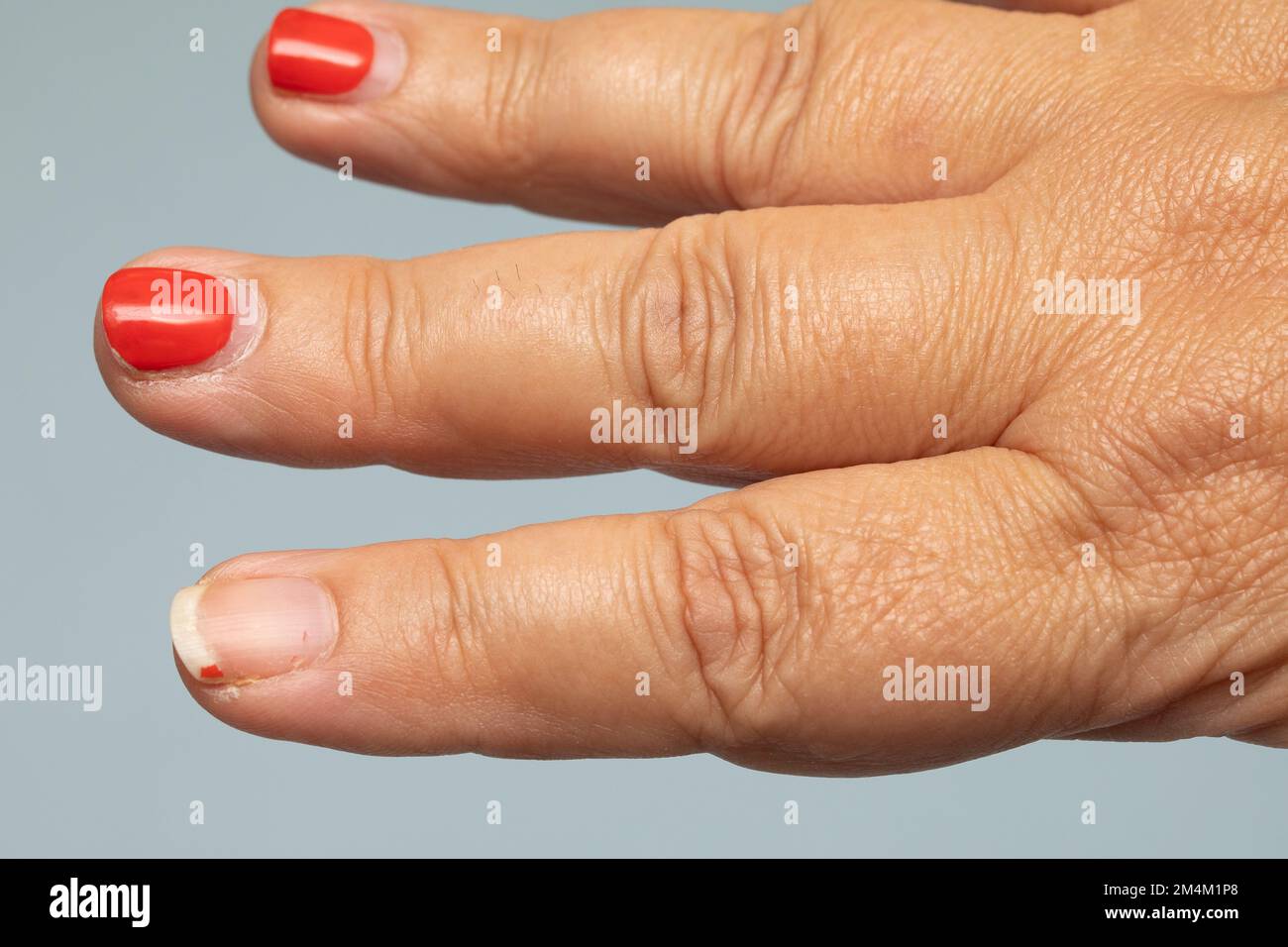 Gros plan des ongles d'une femme avec vernis à ongles rouge ruiné. Concept  de soins du corps de l'esthéticienne. Manucure en ruines. Vernis à base de  gel peeling sur les ongles. Se