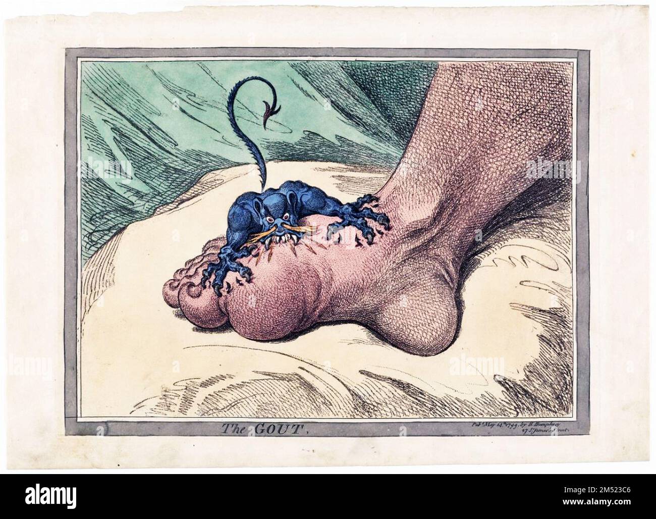 L'artiste James Gillray illustre avec force la douleur et la souffrance causées par la goutte, une maladie courante de son temps. Publié 1799 Banque D'Images