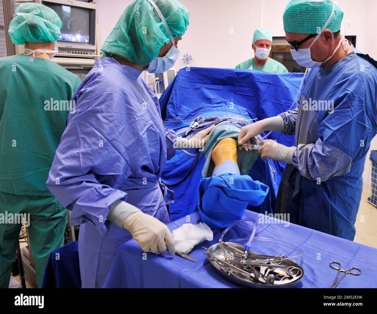 Pour le diagnostic et le traitement de la maladie étendue de l'arthrose, les orthopédistes et les chirurgiens comptent sur l'endoscopie du genou, comme ici dans un Banque D'Images