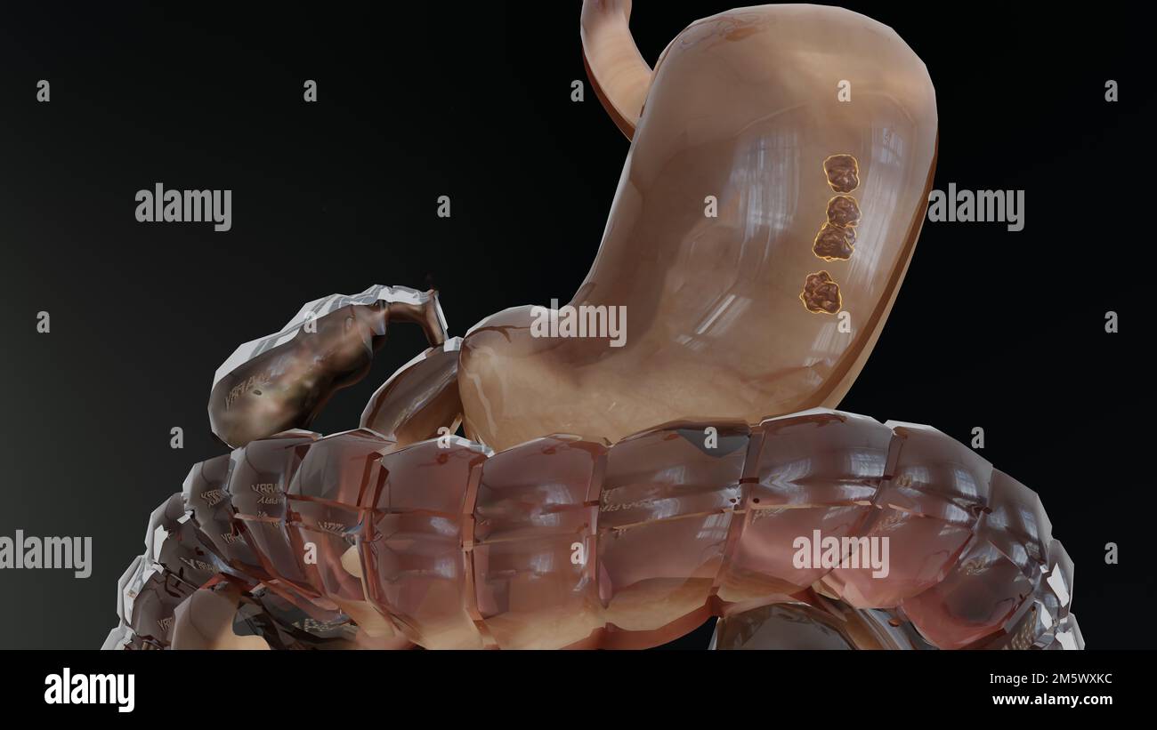 Estomac humain Anatomie digestion, concept de l'intestin, de la bouche aux intestins, laxatif, traitement de la constipation, oesophage, hirondelle Banque D'Images
