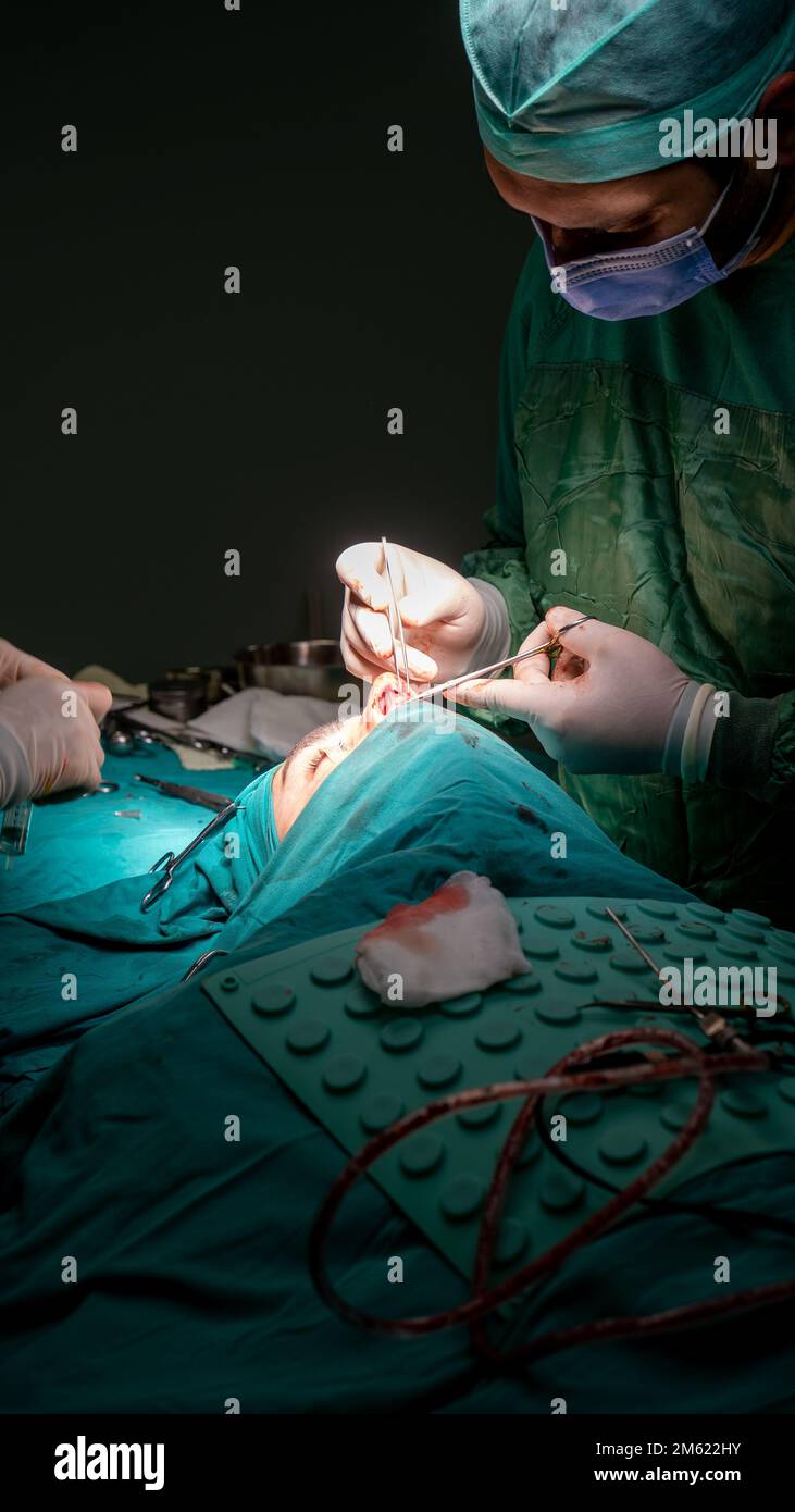 chirurgie de rhinoplastie, défauts dans la forme du nez chez la patiente. Intervention chirurgicale en chirurgie plastique rhinoplastie Banque D'Images