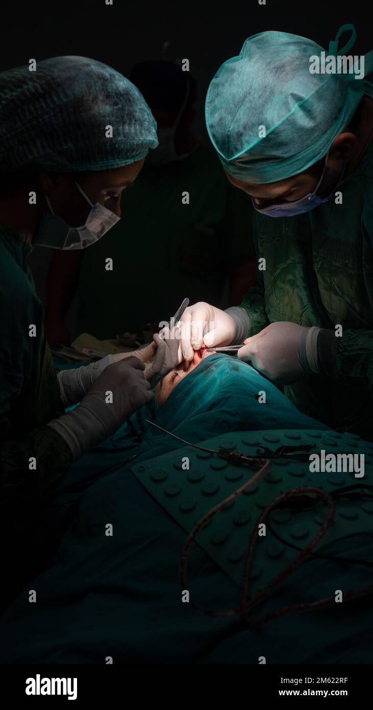 chirurgie de rhinoplastie, défauts dans la forme du nez chez la patiente. Intervention chirurgicale en chirurgie plastique rhinoplastie Banque D'Images