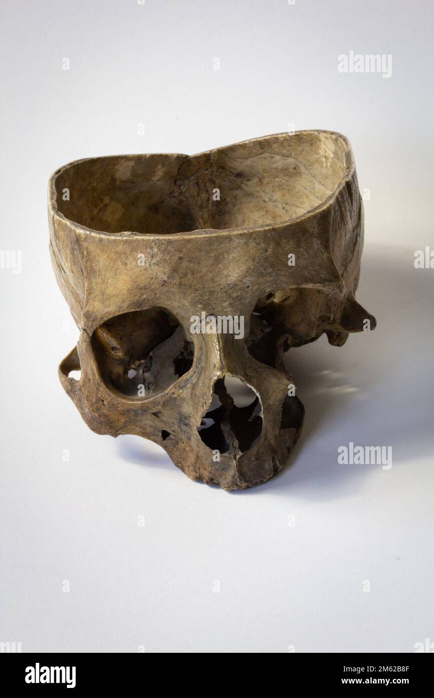 Un crâne humain une exposition scientifique Banque D'Images